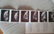 Узи не показывает беременность, задержка тест положительный