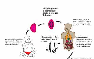 Эффективные методы лечения остриц (энтеробиоза) у взрослого человека