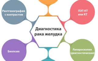 Средства лечения рака желудка: медикаменты