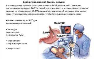 Сколько живут с язвой желудка,  можно ли работать при язвенной болезни и дают ли инвалидность?