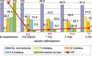 Статистика язвенной болезни желудка: исторический ракурс и современность