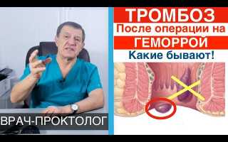 Осталась шишка после операции по удалению геморроя, что делать?